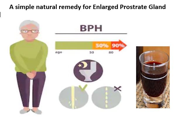 A Simple Remedy For An Enlarged Prostate Gland
